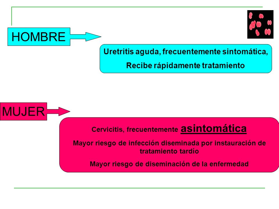 uretritis en el orden de los hombres uretritis en el orden de los hombres